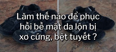 CÂU HỎI 54: Làm thế nào để phục hồi bề mặt da lộn bị xơ cứng, bệt tuyết ?